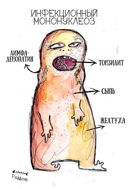Симптомы инфекционных заболеваний.