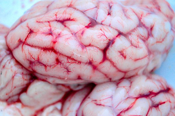 Что такое серозный менингит и как от него защититься