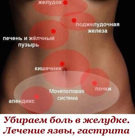 Убираем боль в желудке. Лечение язвы, гастрита