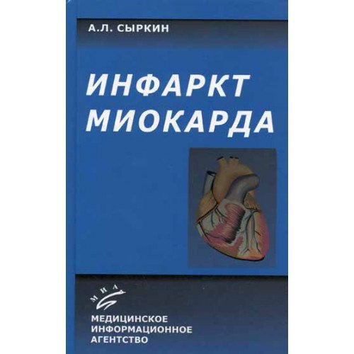 Инфаркт миокарда 