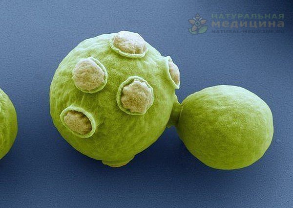 ДPОЖЖИ — ОПАСHОЕ БИОЛОГИЧЕСКОЕ ОPУЖИЕ