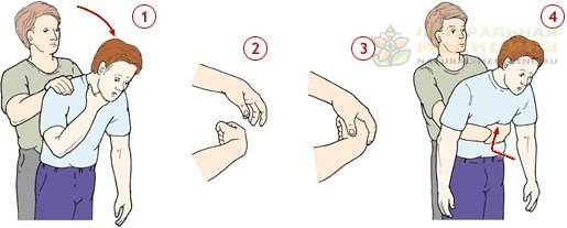 Что делaть, если кто-то подaвился 