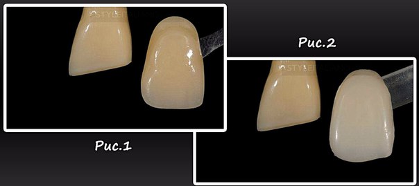 #статьи_alldental