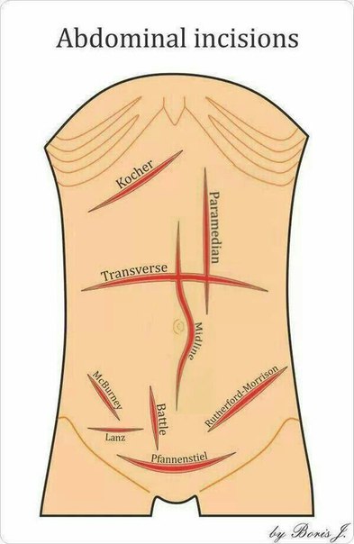 Будущим хирургам на заметку!