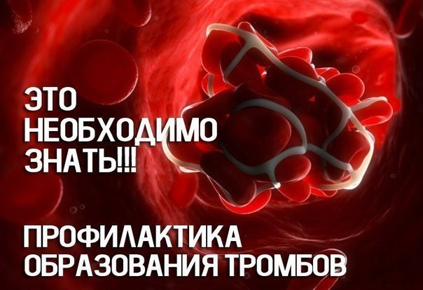 Это необходимо знать! Профилактика образования тромбов 