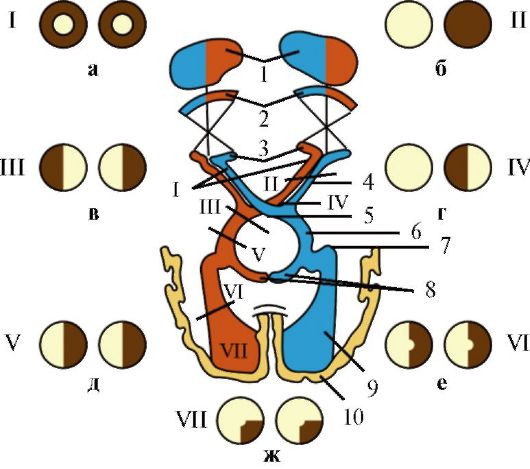 Зрительный анализатор и основные типы нарушений полей зрения (схема). 