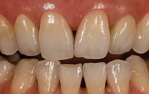 #статьи_alldental #ортопедия_alldental