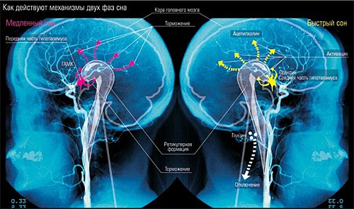 Летаргический сон