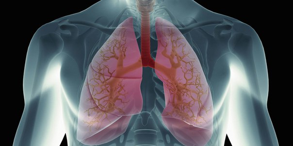 Топ 10 Интересные факты о раке легких 