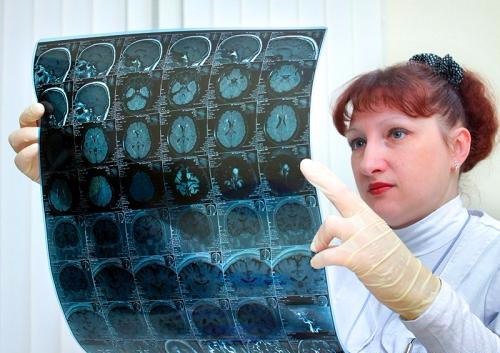 Черепно-мозговые травмы вызывают проблемы с кишечником и заражение крови