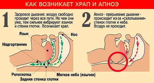 Почeму люди хpапят 