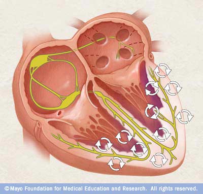 Виды остановки эффективного кровообращения,клиническая смерть. 