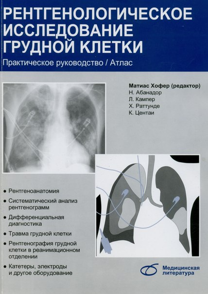 Рентгенологическое исследование грудной клетки. 