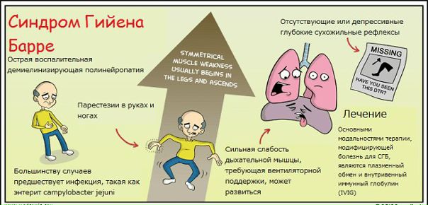  Синдром Гийена - Барре - это заболевание фульминантно развивающееся, ургентное.