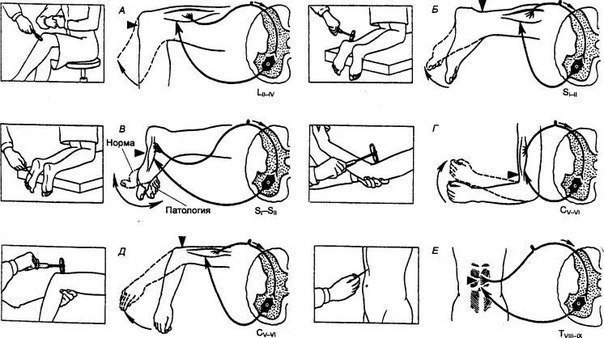 Сухожильные рефлексы 