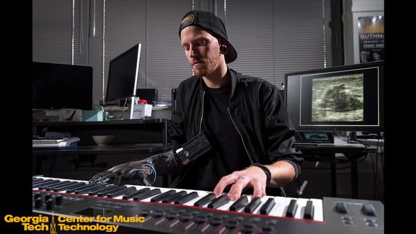 Ученые вернули человеку, потерявшему часть руки, возможность играть на музыкальных инструментах