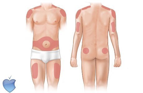 КАК СДЕЛАТЬ УКОЛ ВНУТРИМЫШЕЧНО