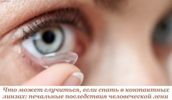 Вот что может случиться, если спать в контактных линзах: печальные последствия человеческой лени. 