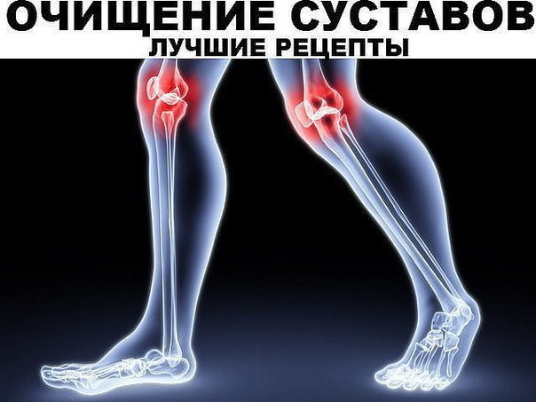 Очищение сосудов. Лучшие методики 