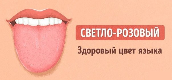 9 проблем, о которых может рассказать цвет языка 