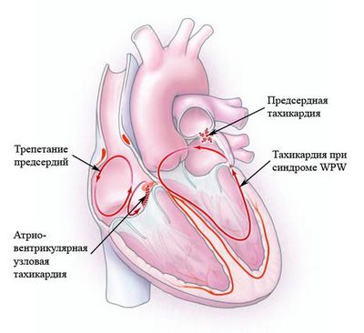 Исследование: энергетики провоцируют сбои в ритме сердца