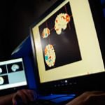 Открытие: инсульт может пробудить тягу к алкоголю