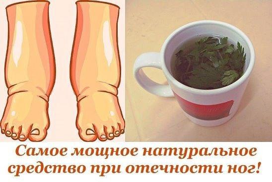 УБИРАЕМ ОТЕКИ НА НОГАХ 