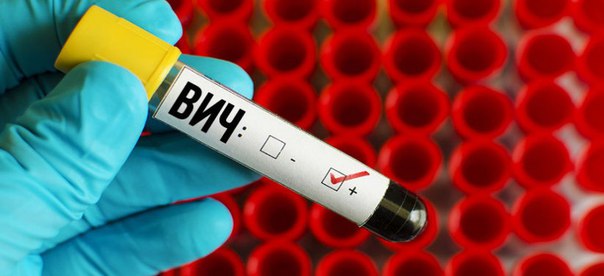 Биологи, кажется, нащупали верный подход в отношении лечения ВИЧ