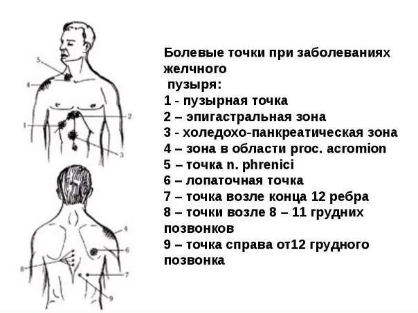 Симптомы желчекаменной болезни 