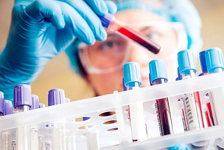 Специалисты советуют ВИЧ-инфицированным употреблять марихуану