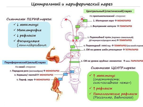 Схемы и таблицы по Неврологии: 