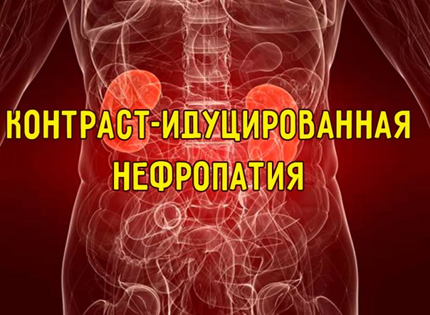 Не хочешь столкнутся с контраст-индуцированной нефропатией (КИН) у своего пациента, знай принципы профилактики.