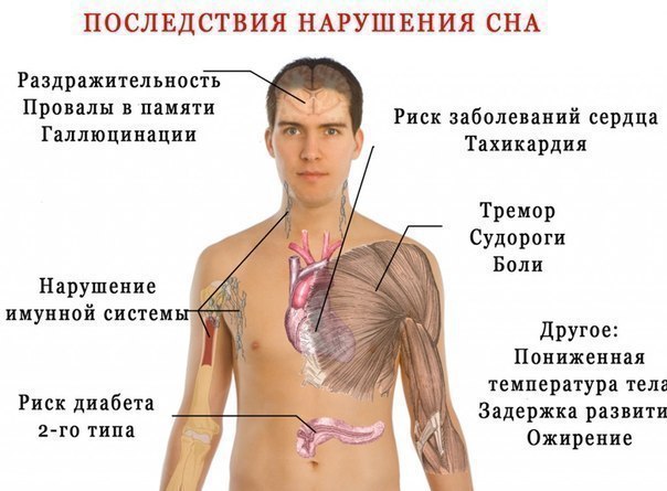 8 Последствий нарушения сна. 
