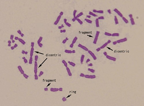 ХРОМОСОМНЫЕ АБЕРРАЦИИ 