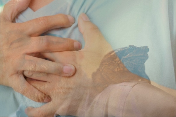 Помни атипичные формы ИМ.