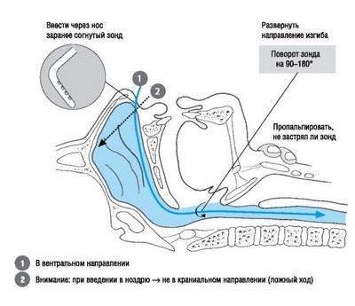 Интраоперационная икота