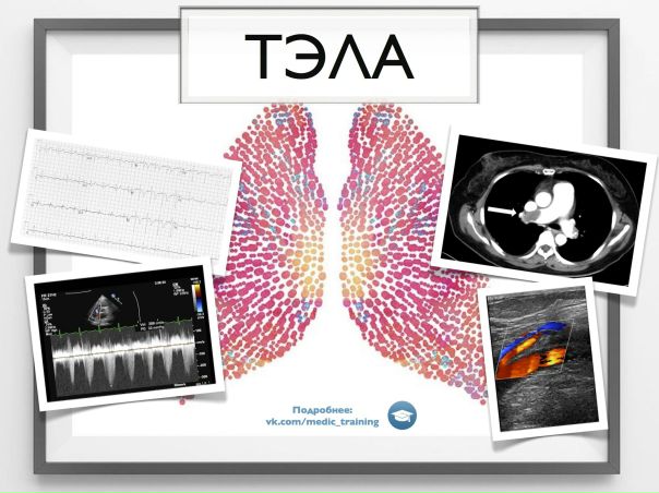 Приглашаем вас на семинар по теме: «Тромбоэмболия легочной артерии». 