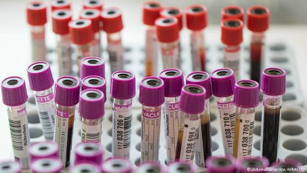 Молодая кровь признана универсальным лекарством против всех болезней