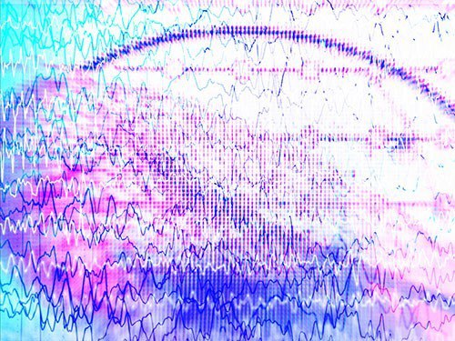 «Фиолетовый день»: правила оказания помощи при эпилептическом припадке