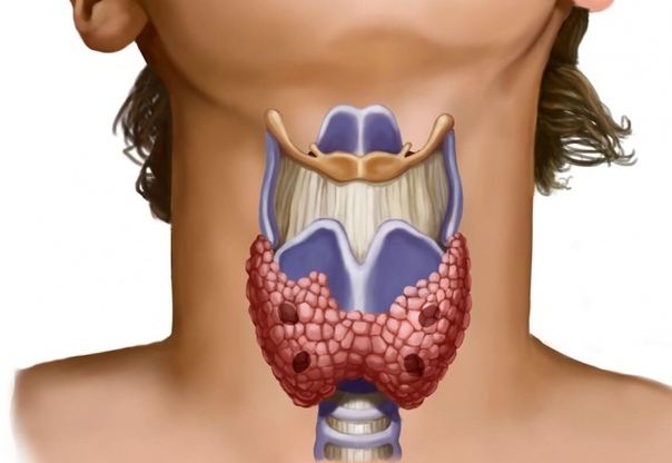 ПОЛЕЗНЫЕ ПРОДУКТЫ ДЛЯ ЩИТОВИДКИ 