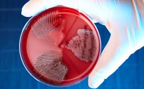 Компонент зубной пасты поможет победить опасную болезнь