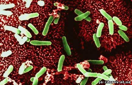Генетики пролили свет на то, как проказа захватила Европу