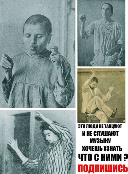 Самые редкие болезни человечества 