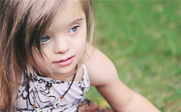 Ученые нашли безопасный способ определения синдрома Дауна у плода 