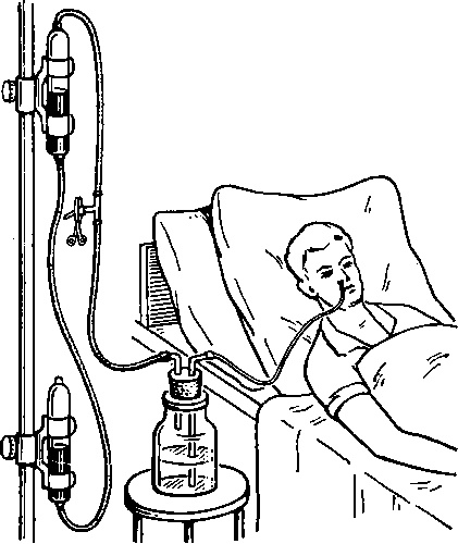 АСПИРАЦИОННОЕ ДРЕНИРОВАНИЕ - активное длительное отсасывание жидкости и газа из полостей тела, ран, особенно послеоперационных, с помощью различных аспираторов. Эти аппараты создают регулируемое разрежение, что обусловливает равномерную и постоянную эвакуацию содержимого полости в коллектор, находящийся в замкнутой системе между аспиратором и больным. Наличие коллектора позволяет судить о количестве, качестве отделяемого и производить микроскопические, биохимические и другие исследования последнего.