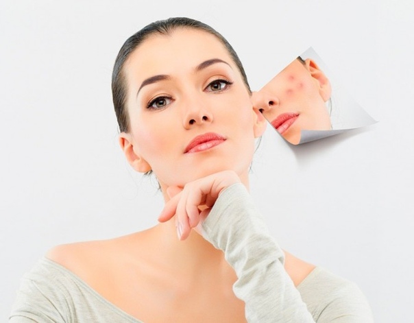 Топ 5 продуктов, которые избавляют от прыщей. 