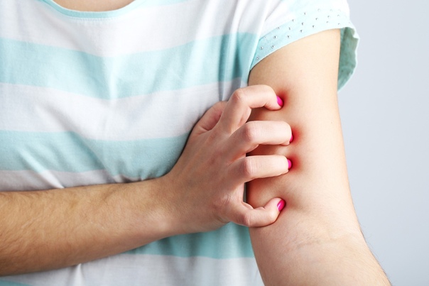 Псориаз и питание 