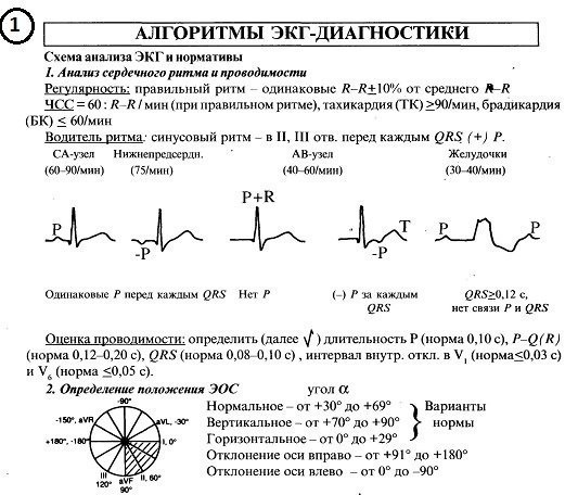 Вторая хорошая шпаргалка по ЭКГ 