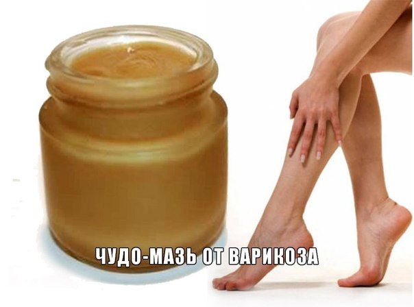 ЕЩЁ ОДИН РЕЦЕПТ ОТ ВАРИКОЗА
