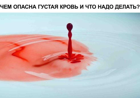 ЧЕМ ОПАСНА ГУСТАЯ КРОВЬ И ЧТО НАДО ДЕЛАТЬ 